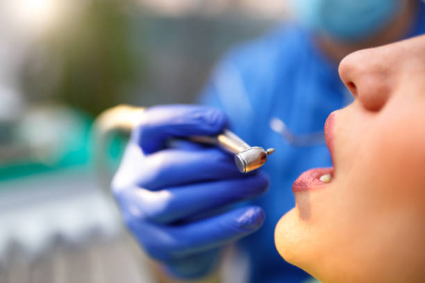 Best Teeth Whitening  in Parker, FL